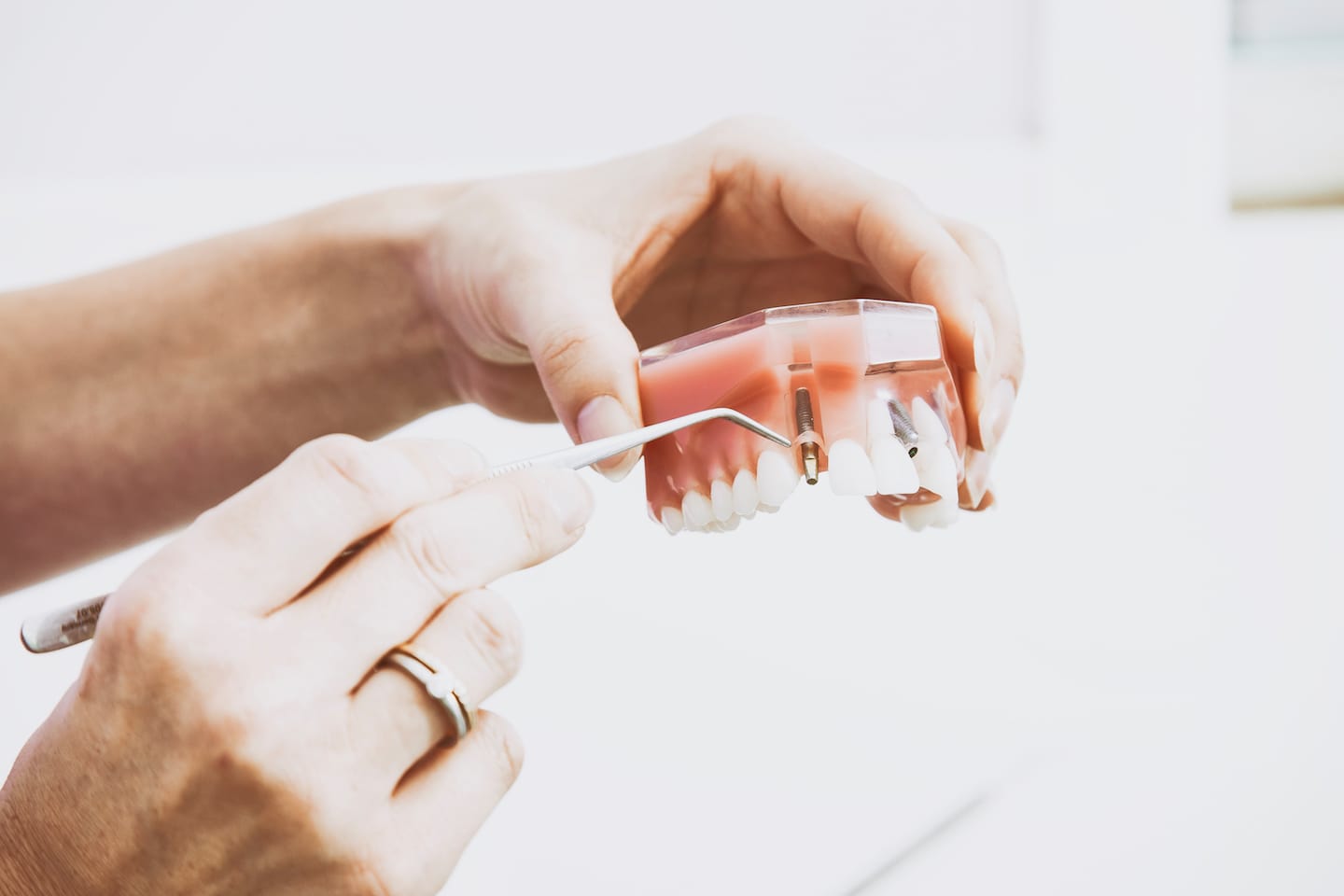 Why You Should Consider Adding Dental Health Coverage